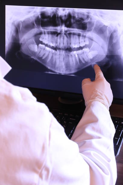 Best Dentist for Tooth Abscess  in University Park, IL