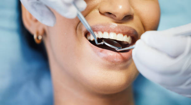 Best Urgent Tooth Repair  in University Park, IL