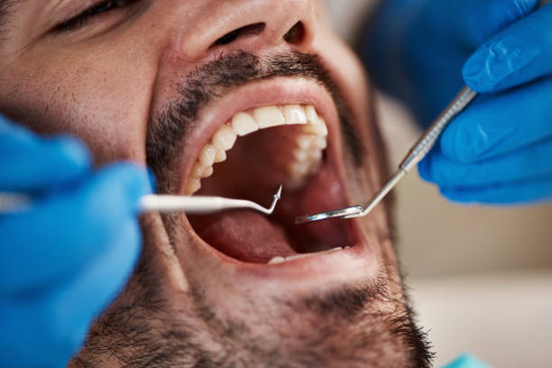 Best Root Canal Emergency Dentist  in University Park, IL