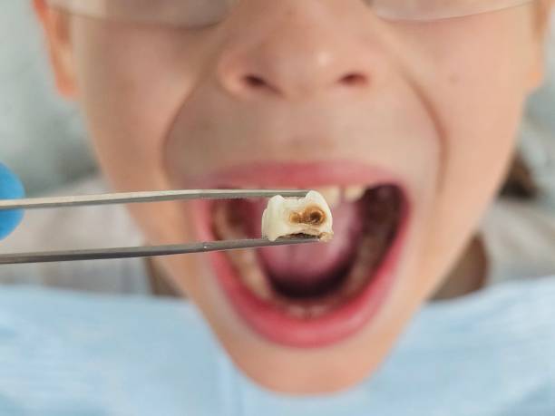 Best Knocked-Out Tooth Emergency  in University Park, IL